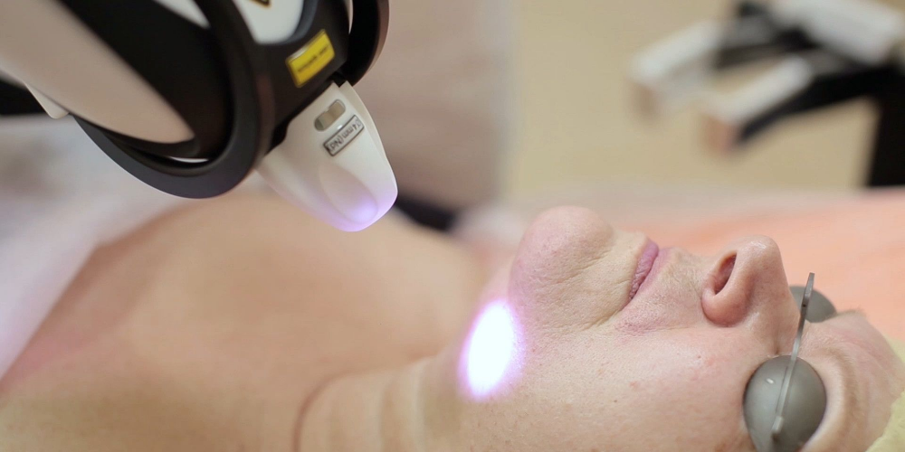 Emisor Nd YAP de conmutación Q