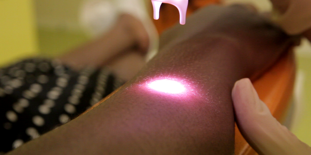 Depilación para cualquier tipo de piel (QOOL-epilation®)