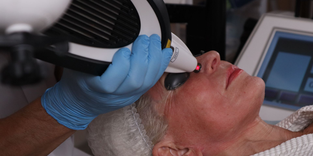 Rejuvenecimiento y lifting de la piel (RecoSMA® en la plataforma MULTILINE™)