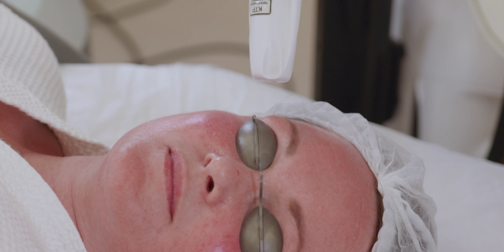 Emisor Nd YAP de conmutación Q