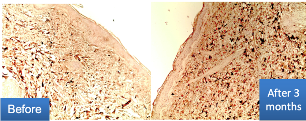 Examen inmunohistoquímico